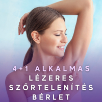 Lézeres szőrtelenítés 4+1 bérlet - NŐK