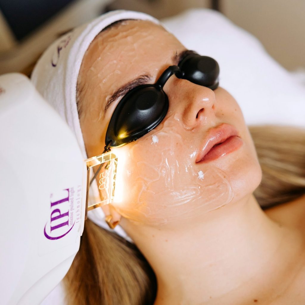 Photorejuvenációs ér - és pigmentkezelés közelről a Bársonyban