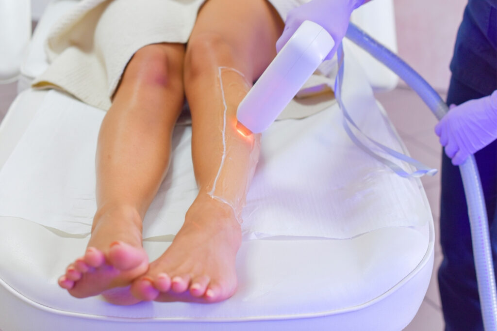 Dióda lézeres szőrtelenítés Bársony