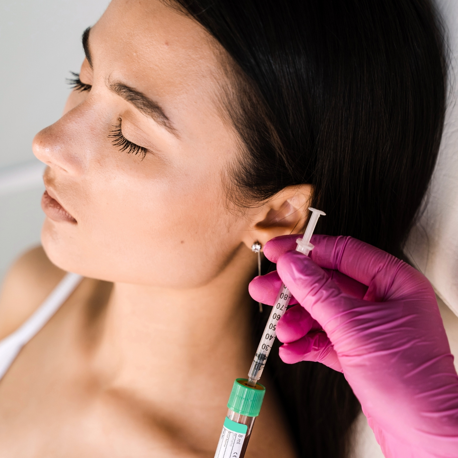 PRP Drakula kezelés Bársony